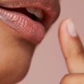 How Long Does Restylane Last?