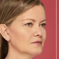 What Does Restylane Do? A Comprehensive Guide